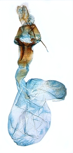 Female genitalia; North Carolina; J.B. Sullivan.
