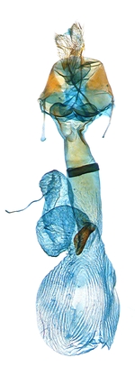 Female genitalia; North Carolina; J.B. Sullivan.