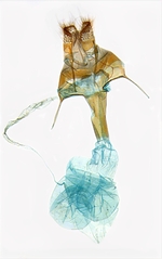Female genitalia; North Carolina; J.B. Sullivan.