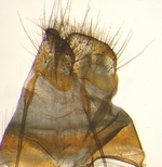 Papillae; North Carolina; J.B. Sullivan.