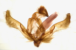 Male genitalia; Wilson County; Jim Petranka.