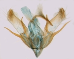 Male genitalia; Watauga County; J.B. Sullivan.