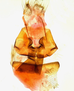 Female genitalia; Orange County; Jim Petranka.