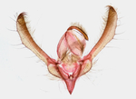 Male genitalia; Richmond County; Jim Petranka (tentative id). 