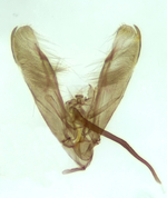 Male genitalia with aedeagus; Henderson County; Jim Petranka. 