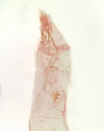 Female genitalia; Madison County; Jim Petranka. 
