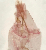 Female genitalia; Madison County; Jim Petranka. 