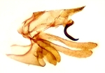 Male genitalia; Cumberland County; Jim Petranka