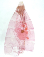 Female genitalia; Richmond County; Jim Petranka (tentative id). 