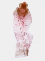 Female genitalia; Richmond County; Jim Petranka.