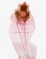 Female genitalia; Richmond County; Jim Petranka.