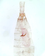 Female genitalia (in situ); Orange County; Jim Petranka. 