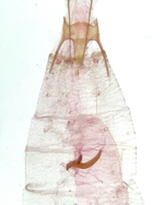 Signum in corpus bursae; Orange County; Jim Petranka. 