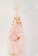 Female genitalia; Orange County; Jim Petranka. 