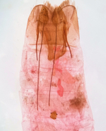 Female genitalia; Richmond County; Jim Petranka.