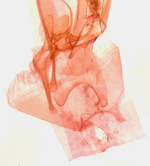 Abdominal plate; Orange County; Jim Petranka.