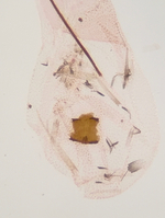 Signum in bursa; Orange County; Jim Petranka.