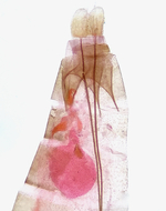 Female genitalia; Richmond County; Jim Petranka.