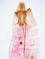 Female genitalia; Madison County; Jim Petranka.