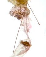 Female genitalia; Madison County; Jim Petranka.