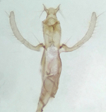 Male genitalia; Orange County; Jim Petranka.