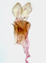 Female genitalia; Orange County; Jim Petranka.