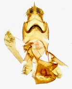 Male genitalia; Cumberland County; Jim Petranka.