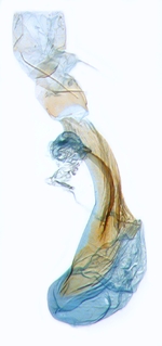 Female genitalia; North Carolina; J.B. Sullivan.