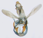 Male genitalia; North Carolina; Jim Petranka.