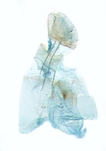 Female genitalia; Carteret County; J.B. Sullivan.