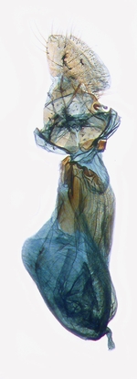 Female genitalia; North Carolina; J.B. Sullivan. 
