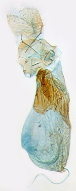 Female genitalia; North Carolina; J.B. Sullivan.