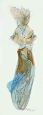 Female genitalia; North Carolina; J.B. Sullivan.