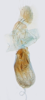 Female genitalia; North Carolina; J.B. Sullivan.