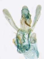 Female genitalia; North Carolina; J.B. Sullivan.
