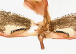 Male genitalia; Mitchell County; Jim Petranka.