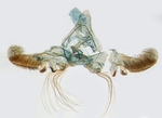Male genitalia; North Carolina; J.B. Sullivan.