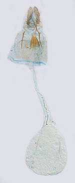 Female genitalia; North Carolina; J.B. Sullivan.