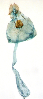 Female genitalia; North Carolina; J.B. Sullivan.