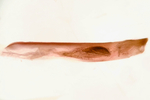 Aedeagus; Madison County; Jim Petranka.