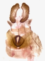 Female genitalia; Henderson County; Jim Petranka. 