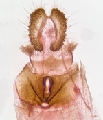 Female genitalia; Henderson County; Jim Petranka.