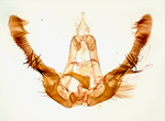 Male genitalia; Cumberland County; Jim Petranka.