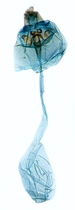 Female genitalia; North Carolina; J.B. Sullivan.