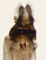 Osmium (unstained); North Carolina; J.B. Sullivan.