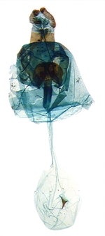 Female genitalia; Ashe County; J.B. Sullivan.