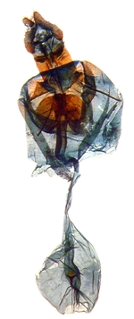 Female genitalia; Ashe County; J.B. Sullivan.