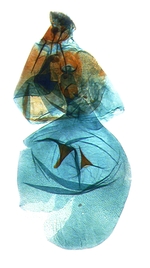 Female genitalia; North Carolina; J.B. Sullivan.