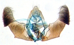 Male genitalia; Craven County; J.B. Sullivan.