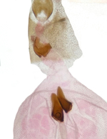Female genitalia; Richmond County; Jim Petranka.